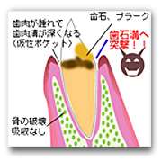 sisyuga2