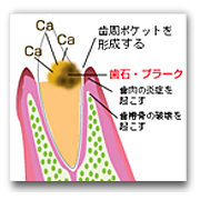 sisyuga3